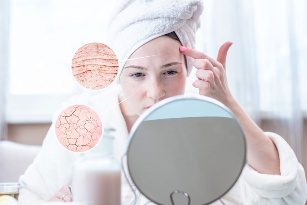 как увлажнить сухую кожу лица